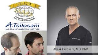 Hair transplantation - Dr. A. Tsilosani, ISHRS Fellow