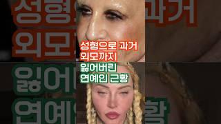 [충격근황]나이 먹어서? 성형후, 과거외모까지 잃은 헐리우드 근황 #쇼츠 #성형부작용 #마돈나 #멕라이언 #헐리우드