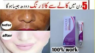 Rang gora karne wali cream|Whitening cream|Rang gora karne ka tarika