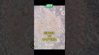 Ginger vs. Bacteria Under the Microscope! 🫚