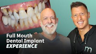Full Mouth Dental Implant Experience - Follow this actual patient from start to finish!