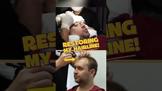 From Procedure to Transformation | Dan’s FUE Journey ‍️