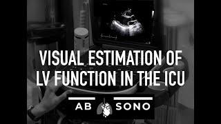 Assessment of LV function in the critically ill