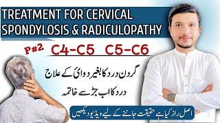 Gardan ka dard | cervical spondylosis treatment | Neck pain | gardan ke dard ki exercise