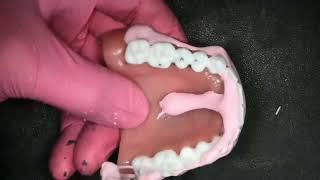 How to polish a 3D printed denture