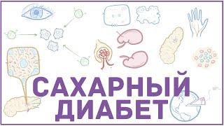 Сахарный диабет - 1 и 2 тип, причины, симптомы, кетоацидоз, гиперосмолярная гипергликемия