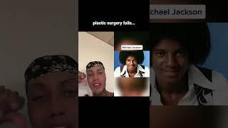 plastic surgery fails