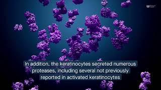 Melanoma stimulates keratinocyte proteolytic activity