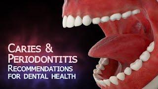 Prevent Caries & Periodontitis - Dental Health Recommendations (Animation)