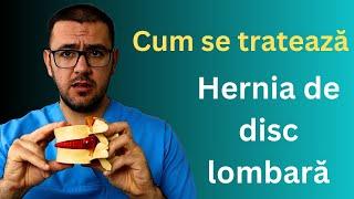 Cum tratez hernia de disc lombară