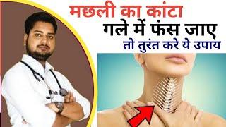 मछली का कांटा गले में फस जाए तो ये 5 घरेलू नुस्खो में कोई एक आजमाए तुरंत। How to Unstuck Fish Bone? 