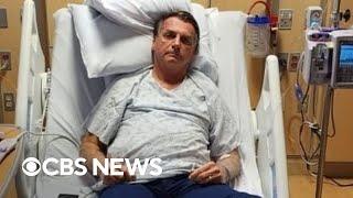 Former Brazilian President Jair Bolsonaro released from Florida hospital