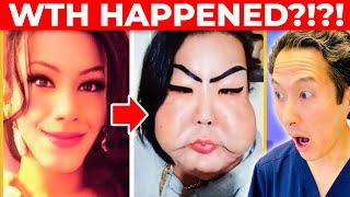 Botched Surgery Gone WILD! JUJU DO PIX! Extreme Bodies Explained!