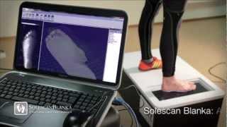 Blanka SOLESCAN STT Structured Light Foot Scanner