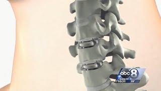 Second Sunday Bryan Health Report: Mobi-C Cervical Disc