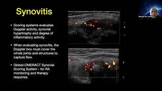 Dr  Jeimylo De Castro talks about Spectrum of pediatric MSK Ultrasound