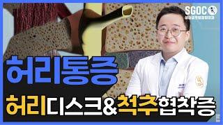 대구정형외과 [대구 삼성글로벌정형외과]  허리통증의 원인, 진단. 그리고 치료법.