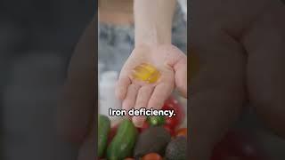 Anemia Unveiled The Iron Deficiency