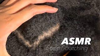 ASMR Gentle Scalp Scratching for Relaxation