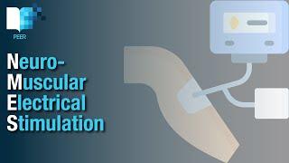 Neuromuscular Electrical Stimulation (NMES): What it is, how it is applied and a summary of evidence