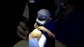 The SAFE and EFFECTIVE Way to Restore Your Hairline with Transplant