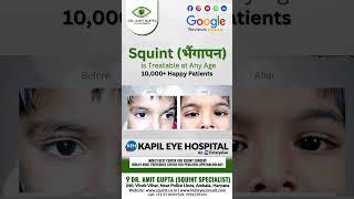Can Squint Be Treated At Adult Age? Dr. Amit Gupta Squint Specialist