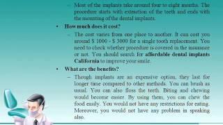 Pasadena dental implantsCalifornia smile dental