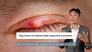 Cancer of the...Eyelids? | Dr E-Shawn Goh (Eagle Aesthetics & Surgery)