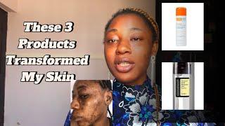 My Transformative 3 Step Skincare Routine #skinupdate #skintransformation #youfam