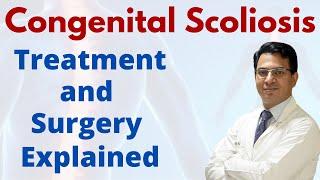 Congenital scoliosis - Timing & Surgery - Congenital scoliosis Surgery in India #drhiteshgarg