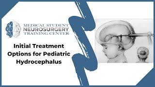 Initial Treatment Options for Pediatric Hydrocephalus