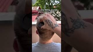 Your not getting bald it your choice