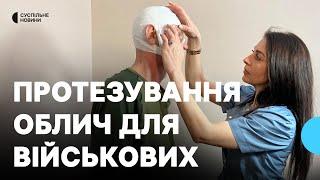 «Новий рівень в нашій практиці». Протезування обличчя почали проводити у військовому шпиталі Харкова