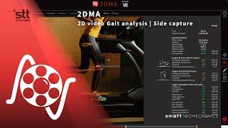 Gait 2DMA | 2D gait video analysis | Side capture