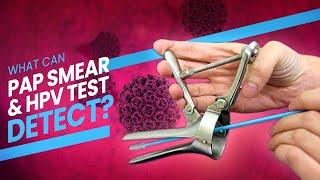 Pap Smear (Pap Test) and HPV Test - A step by step guide (3D) at what happens during the test