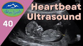 Fetus Heartbeat Ultrasound - for relaxation, sleeping, healing (sound therapy)