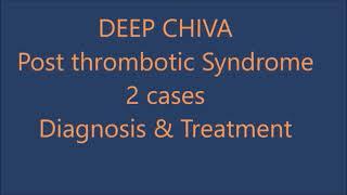 CHIVA hemodynamics applied to deep venous insufficiency and venous malformations