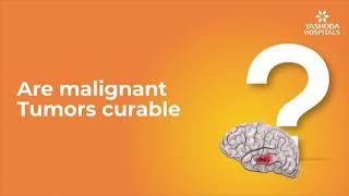 Are malignant Tumors curable? | Brain Tumor Treatment | Yashoda Hospitals Hyderabad