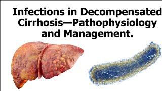 Infections in Decompensated Cirrhosis: Pathophysiology and Management.