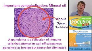Docusate: a stool softening laxative