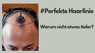 Perfekte Haarlinie - Warum nicht etwas tiefer? | #8