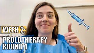 Caring Medical Week 2 // Prolotherapy For Cervical Instability & Neck Curve Progress