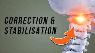 ATLAS Misalignment // Upper Cervical Instability Exercises