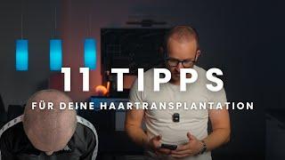 11 Tipps für deine Haartransplantation in Istanbul - With Subtitles