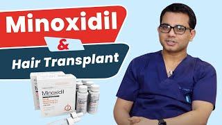 Do I need to take Minoxidil After Hair Transplant? | Best Hair Transplant Surgeon- Dr.Jangid | Delhi