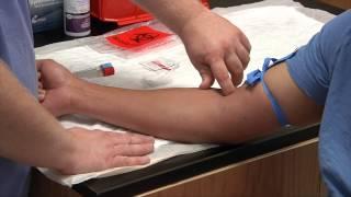 Phlebotomy: Multi-Sample (Straight Stick) Needle System