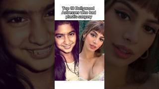 Top 10 bollywood actresses who had plastic surgery.#shortvideo#videotop10 #actress#video