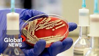 E. coli outbreak: How to protect yourself from bacteria, infection?