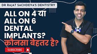 Which is better All-on-4 or All-on-6 dental implants procedure? Hybrid Prosthesis vs. Implant Bridge