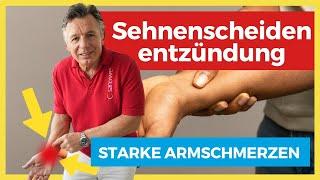 Starke Armschmerzen ️ Sehnenscheidenentzündung - Verliere keine Zeit! Mach DAS!